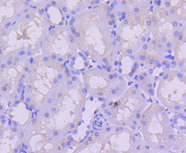 Anti-PMS2 Antibody (2B500)