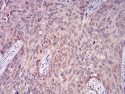 Anti-PLCγ1 Antibody (8G514)