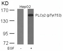 Anti-Phospho-PLCg2 (Tyr753) Polyclonal Antibody