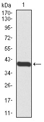 Anti-PRDM1 Antibody (4L235)