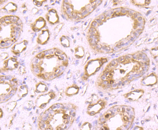 Anti-PLEKHH1 Antibody (8U514)