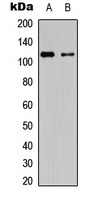 Anti-Phospho-PRKD1/2/3 (Ser738/742) Polyclonal Antibody