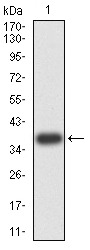 Anti-PRDM4 Antibody (8D792)
