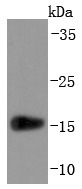 Anti-Transthyretin Antibody (5V428)