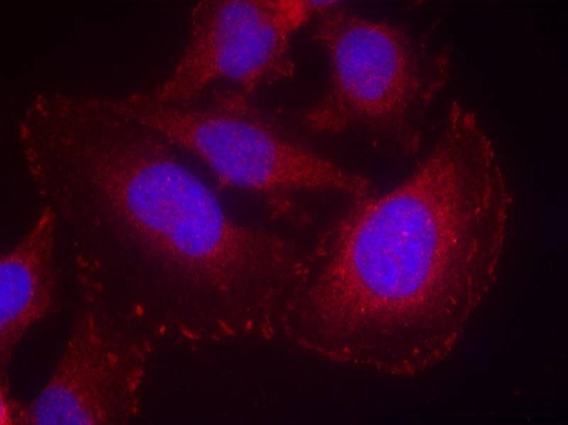 Anti-Phospho-PLCγ1 (Tyr771) Polyclonal Antibody