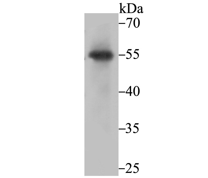 Anti-PIST Antibody (5T628)