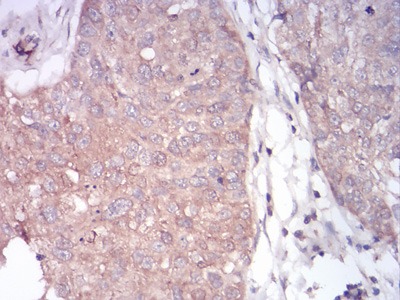 Anti-PLCγ1 Antibody (8G514)