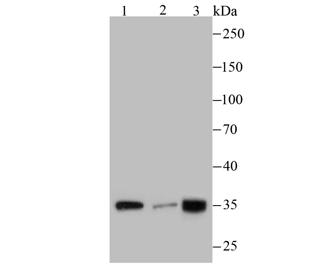 Anti-PLEKHH1 Antibody (8U514)