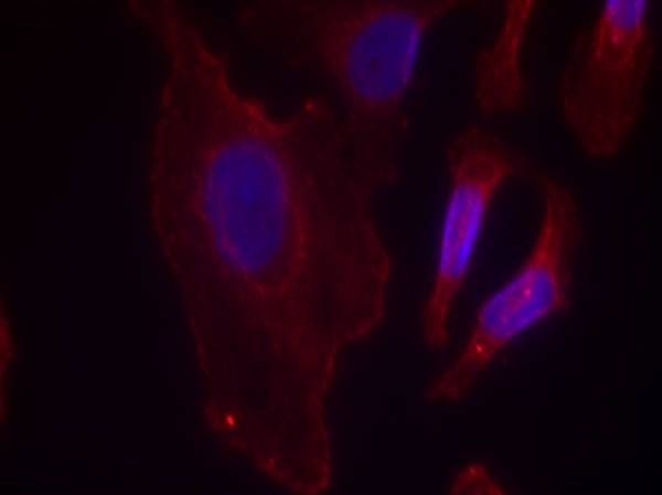 Anti-Phospho-PLCg2 (Tyr753) Polyclonal Antibody