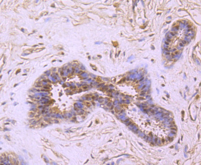 Anti-PRMT1 Antibody (6O126)