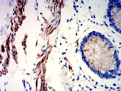 Anti-PRKAG3 Antibody (6D439)