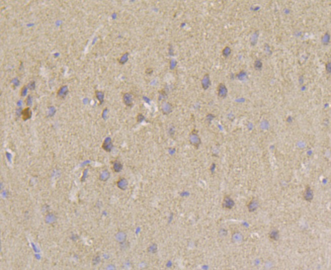 Anti-PIST Antibody (5T628)