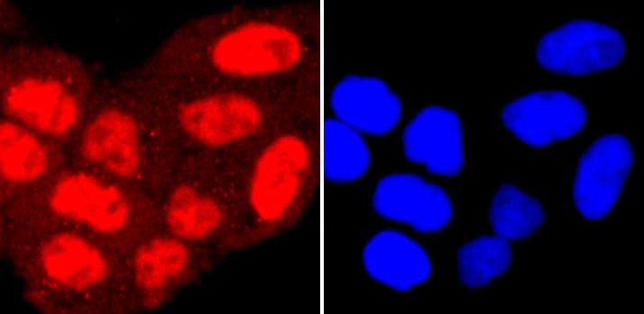 Anti-PRMT1 Antibody (6O126)