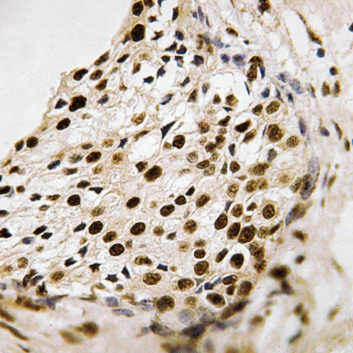 Anti-Phospho-PRAK/MAPKAPK5 (Thr182) Polyclonal Antibody