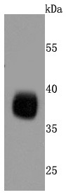 Anti-Podoplanin Antibody (9X102)