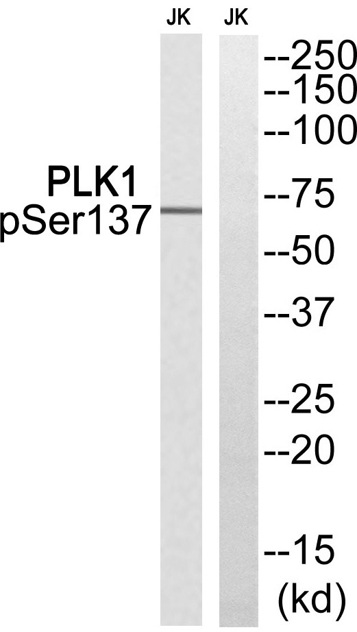 Anti-Phospho-PLK1 (Ser137) Polyclonal Antibody