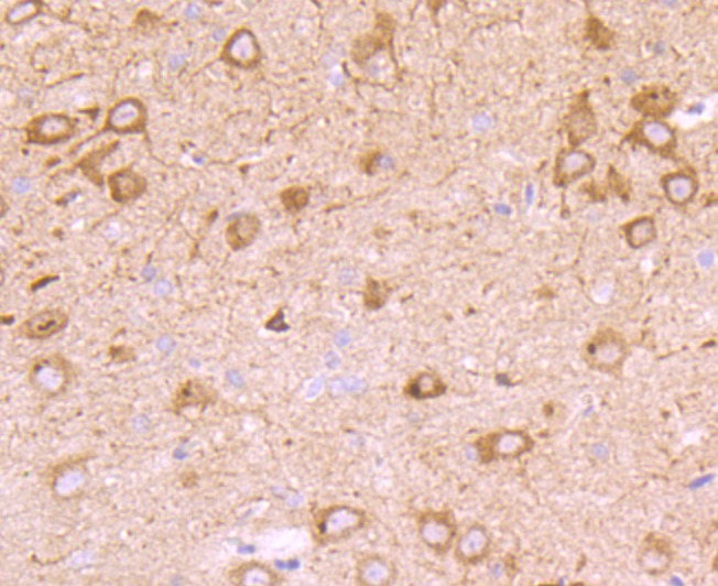 Anti-PMP22 Antibody (3X860)