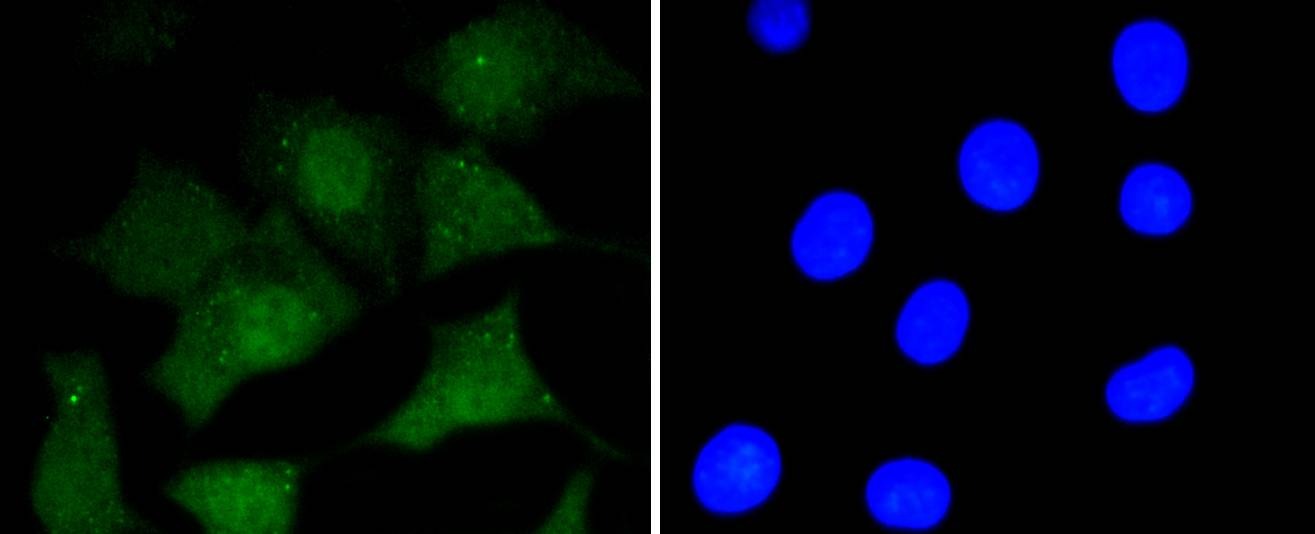 Anti-PRNP/Prion Antibody (2B223)
