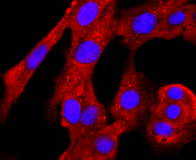 Anti-PRMT1 Antibody (6O126)