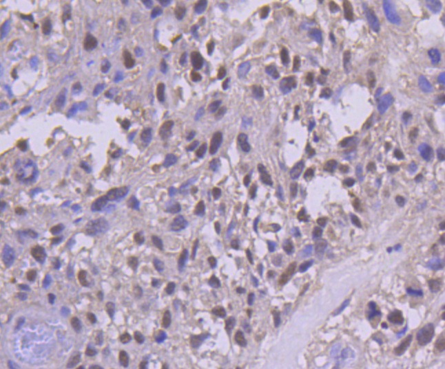 Anti-PMS2 Antibody (2B500)