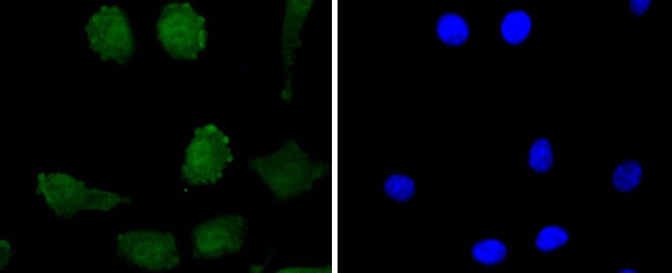 Anti-PRNP/Prion Antibody (2B223)