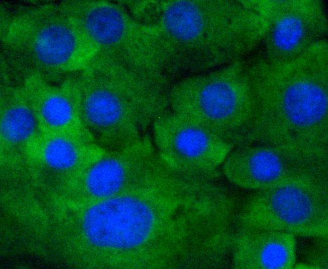 Anti-Phospho-MAP2K1 (Ser218, 222) Antibody (3S158)