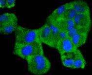 Anti-Phospho-MAP2K1 (Ser298) Antibody (9P567)