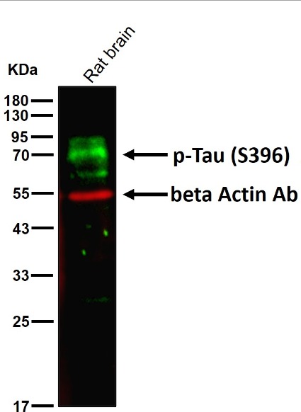 Anti-Phospho-MAPT (Ser396) Antibody (4F595)
