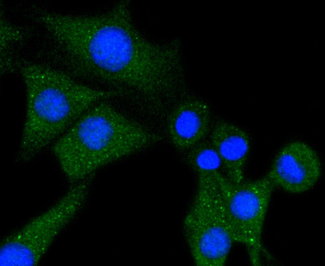 Anti-Phospholipase C gamma 1 Antibody (7V238)