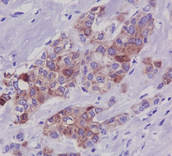 Anti-Phospho-MAPT (Ser396) Antibody (4F595)