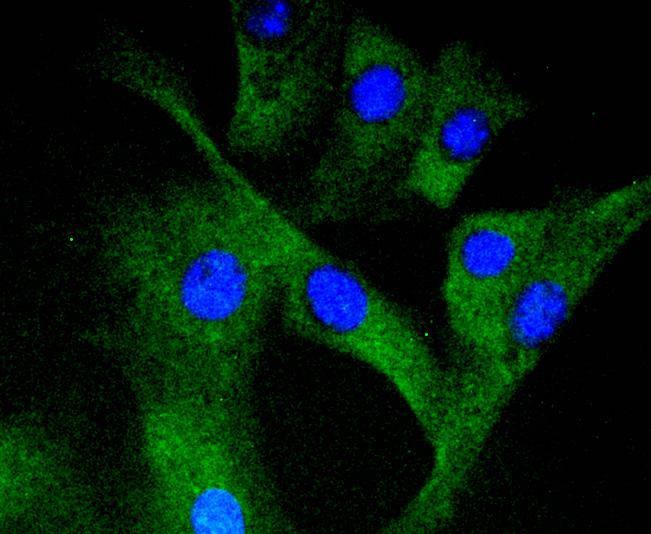 Anti-Phospho-MAP2K1 (Ser298) Antibody (9P567)