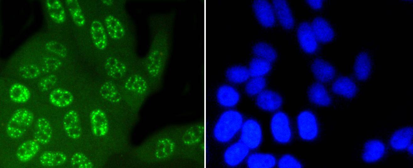 Anti-Phospho-JNK1/2/MAPK10 (Thr183/183/221) Antibody (7N200)