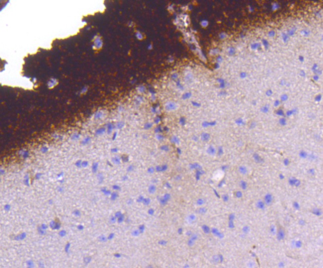 Anti-Phospho-Synapsin-1 (Ser9) Antibody (8A406)