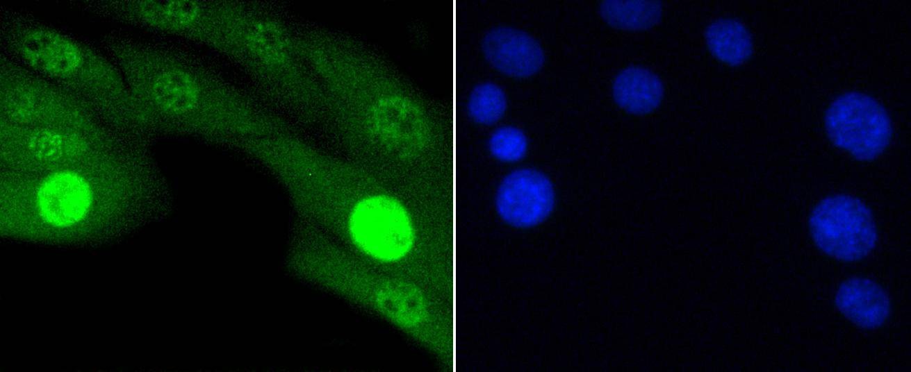 Anti-Phospho-JNK1/2/MAPK10 (Thr183/183/221) Antibody (7N200)