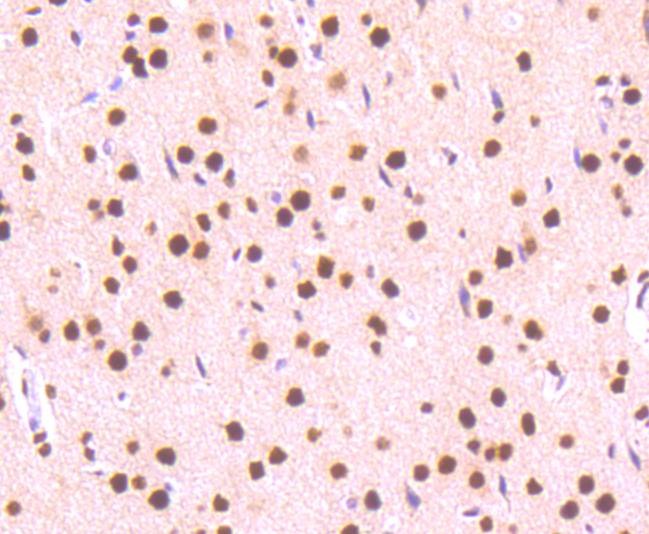 Anti-Phospho-STAT3 (Ser727) Antibody (9W152)
