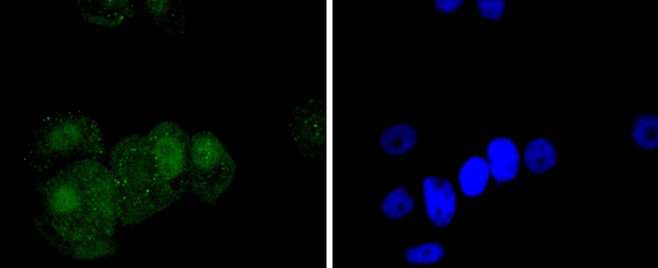 Anti-Phospho-JUN (Ser63) Antibody (4N22)