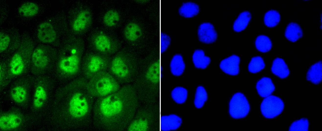 Anti-Phospho-STAT3 (Ser727) Antibody (9W152)