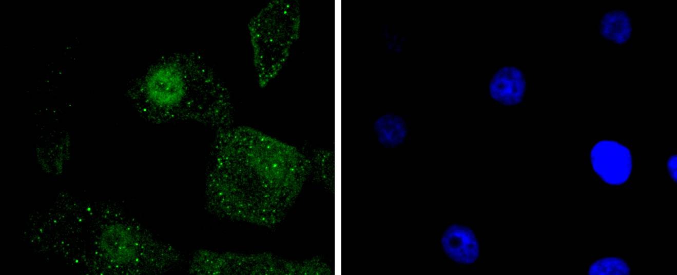 Anti-Phospho-JUN (Ser63) Antibody (4N22)