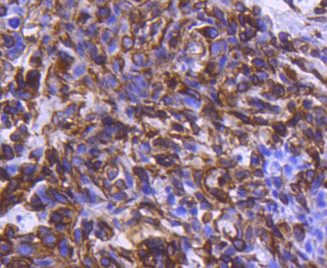 Anti-Phospho-CHEK1 (Ser296) Antibody (1L434)