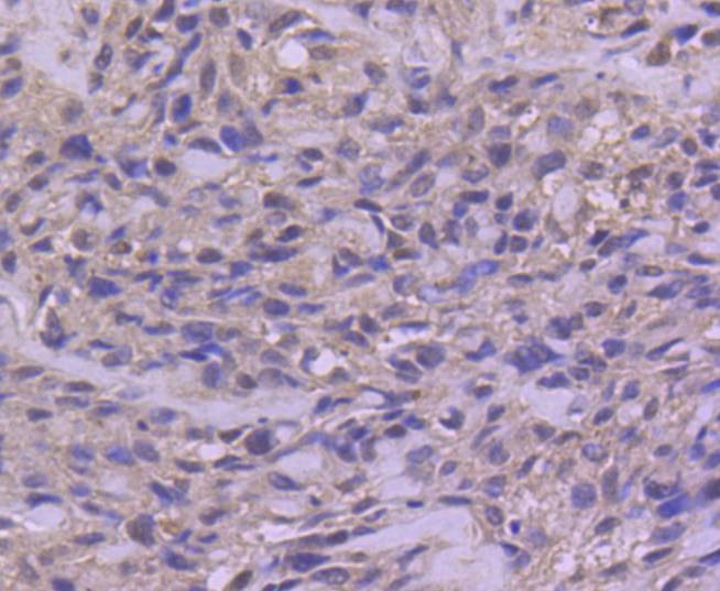 Anti-Phospho-JUN (Ser63) Antibody (4N22)