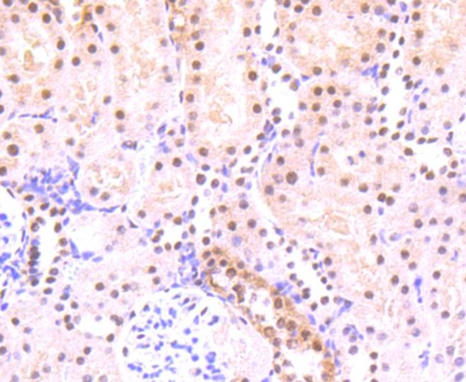 Anti-Phospho-STAT3 (Ser727) Antibody (9W152)