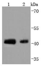 Anti-Phospho-JUN (Ser63) Antibody (4N22)