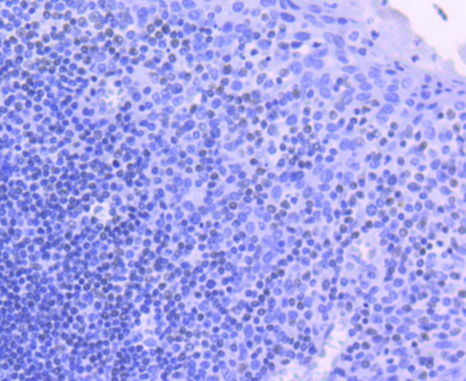 Anti-Phospho-JAK2 (Tyr1007, 1008) Antibody (1D853)