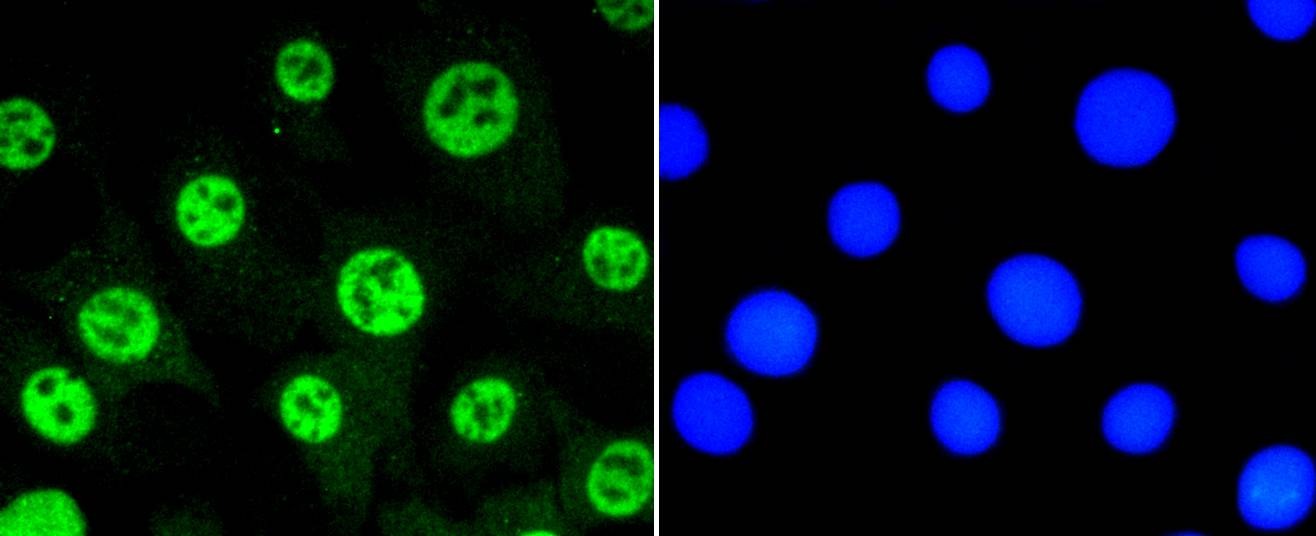 Anti-Phospho-STAT3 (Ser727) Antibody (9W152)