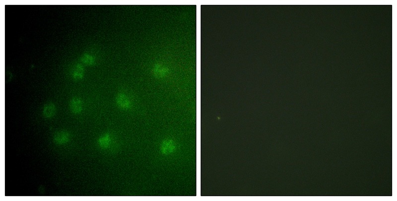 Anti-Phospho-RB1 (Thr826) Polyclonal Antibody