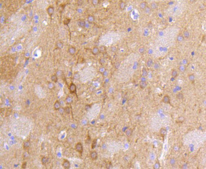 Anti-DLG4 Antibody (7K534)