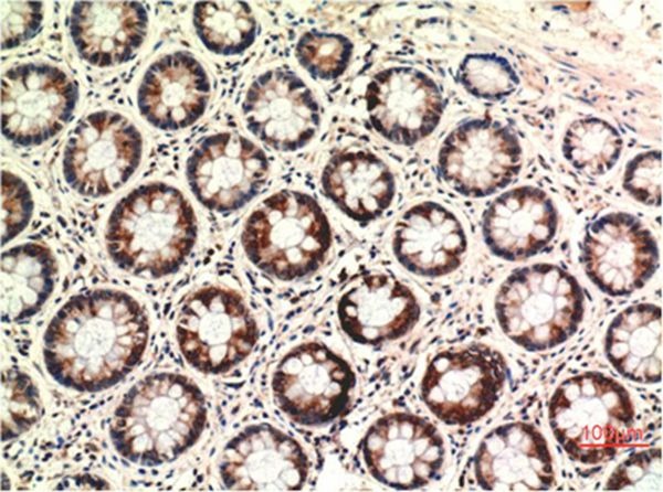 Anti-PTEN Antibody (9C831)