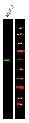 Anti-Phospho-RARA (Ser96) Polyclonal Antibody