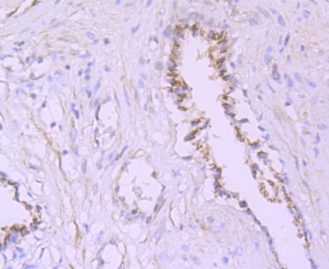 Anti-PSME1 Antibody (8P627)