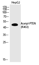 Anti-Acetyl-PTEN (Lys402) Polyclonal Antibody